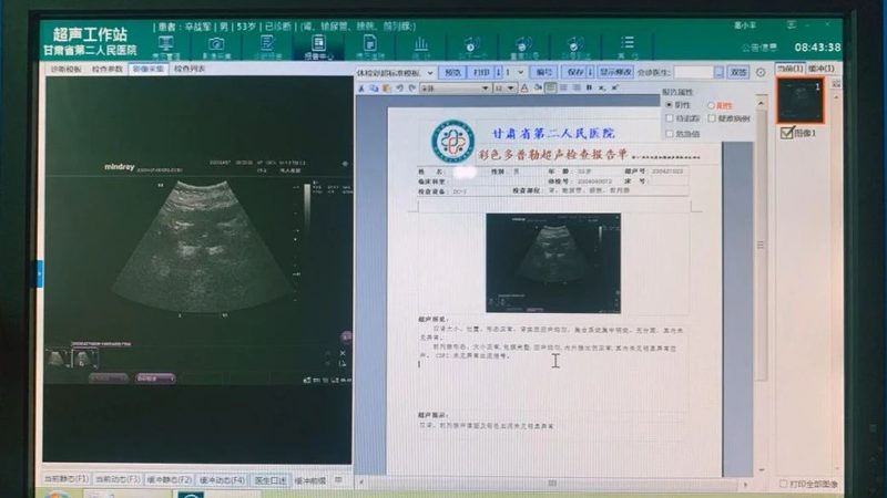 体检中心血常规套餐，揭秘背后的价格与价值